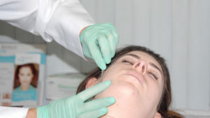 dermaplaning in NYC